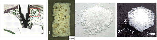 新規骨再生材料開発に関する研究