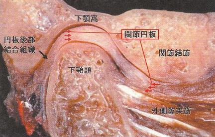 法 額 症 治療 関節 痛