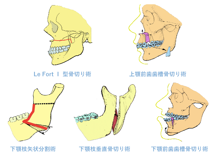 顎変形症外来 大阪歯科大学附属病院